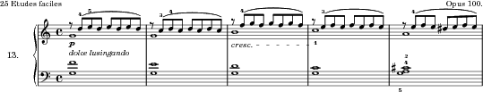 Consolation, Op. 100 No. 13 score preview