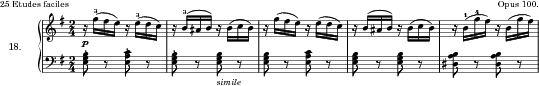 Inquiétude, Op. 100 No. 18 score preview