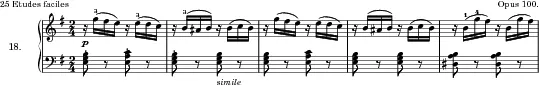 Inquiétude, Op. 100 No. 18 score preview
